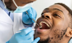 Extração dentária: Quando e por que remover um dente?